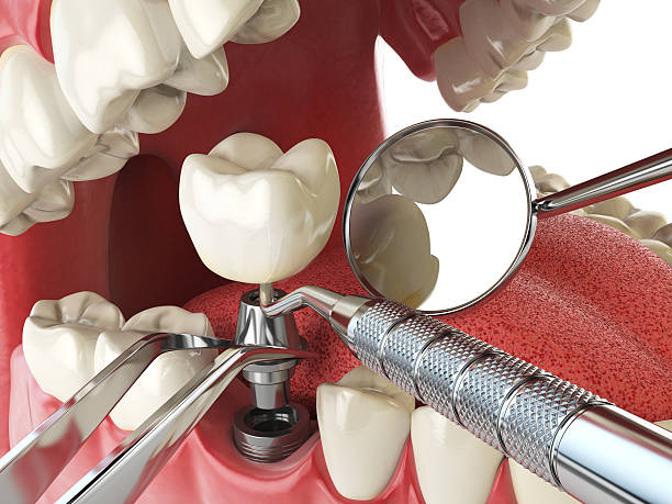 Best Emergency Dental Care for Broken or Chipped Teeth in Hominy, OK